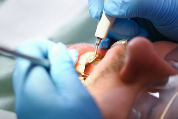 Best Emergency Treatment for Dental Infections or Abscesses in North Crossett, AR